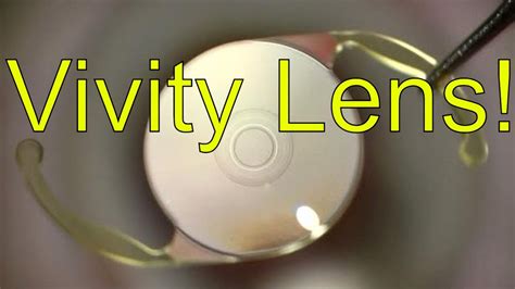 VIVITY lens for cataract surgery - Mechanism of Action - Dr Simon Chen ...