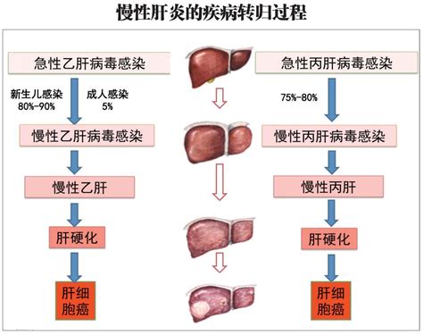 到底多少药物或毒素会引起肝炎