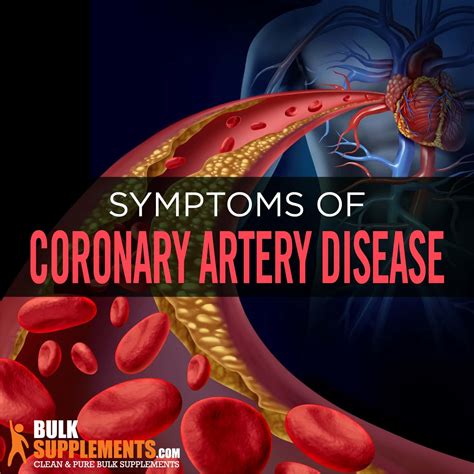 Coronary Artery Disease Symptoms