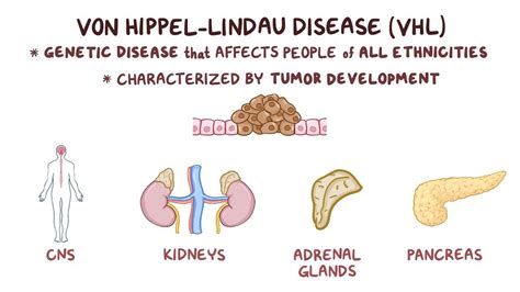 von Hippel-Lindau disease: Video, Anatomy & Definition | Osmosis