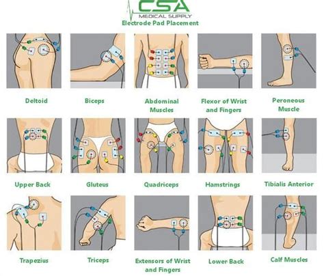 TENS Unit Therapy: How To Use Them For Pain Relief | Tens electrode ...