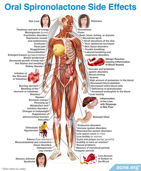 Spironolactone in Acne Treatment - Acne.org