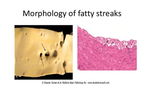 Cardiovascular system pathology lab