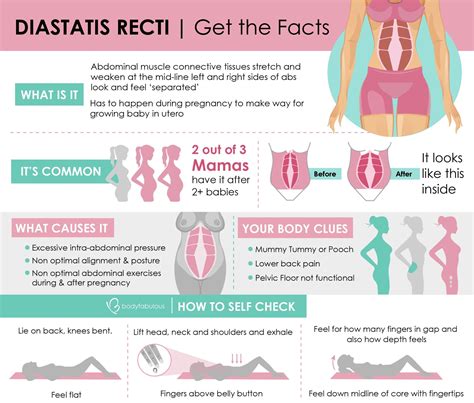 How to measure your Diastatis Recti / Abdominal Separation ...