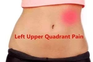 Left Upper Quadrant Pain: 16 Causes with Treatments