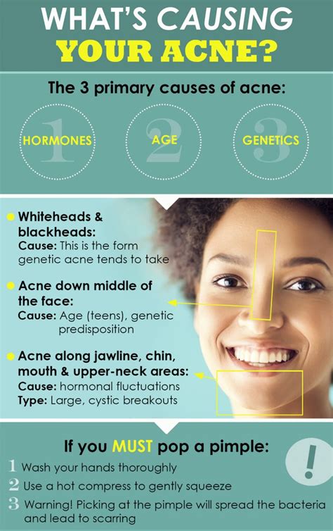 What is Acne: Types, Causes, Signs & Symptoms, Treatment