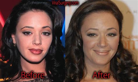 Leah Remini Plastic Surgery: Before and After Botox, Boob Job Pictures