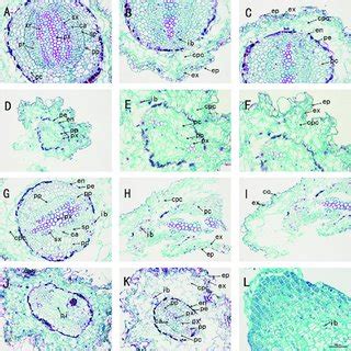 The anatomy of adventitious root of Taxus chinensis var. mairei ...