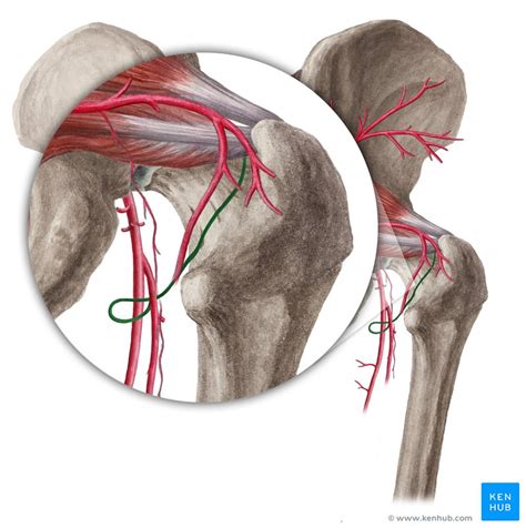 Anomalous Configuration Of Medial And Lateral Circumflex Femoral Arteries | Images and Photos finder