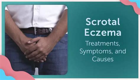 Scrotal Eczema: Symptoms, Causes, And Treatment, 59% OFF