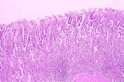 Stomach Histology - Pyloric region of stomach - histology slide