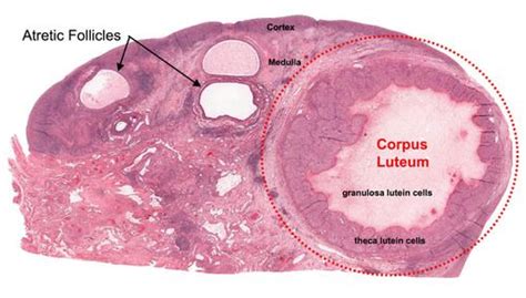 Ovary - Corpus Luteum Histology