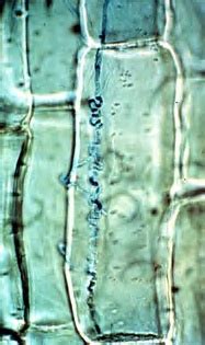 Grasses and endophytic fungi - microbewiki