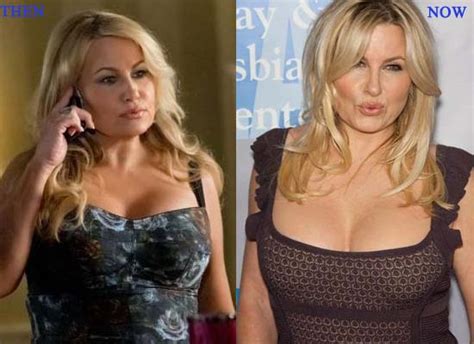 Jennifer Coolidge Plastic Surgery Before And After