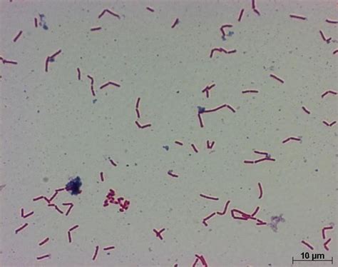 Clostridium ramosum - Alchetron, The Free Social Encyclopedia