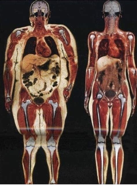 VISCERAL FAT: UNDERSTANDING HOW IT AFFECTS YOUR HEALTH NOW AND IN THE FUTURE – CrossFit Boston ...