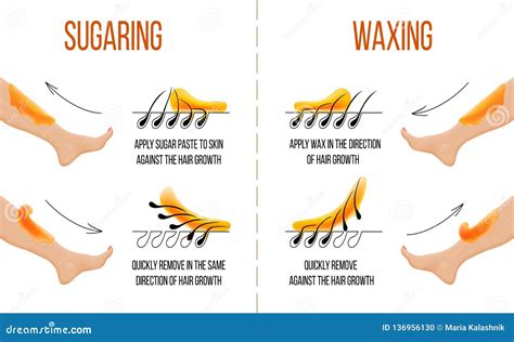 Waxing. Hair Removal. Smooth Clear Skin. Epilation And Depilation Of Hair. Vector Illustration ...