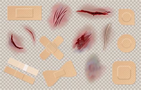 Skin wounds stock illustration. Illustration of hematoma - 74056337