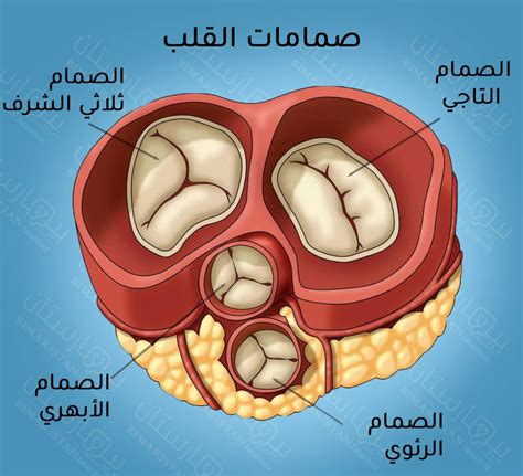 عملية إصلاح الصمام التاجي في تركيا - بيمارستان