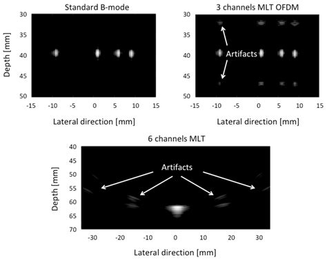 Applied Sciences | Free Full-Text | Practical Guide to Ultrasound Beam Forming: Beam Pattern and ...