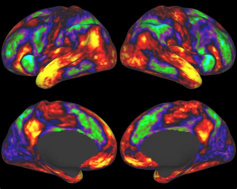 Brain mapping; Brain Electrical Activity Mapping; Topographic Brain ...