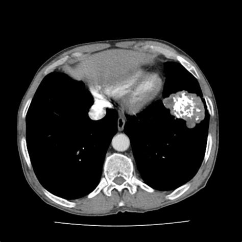 Viewing playlist: 111-DECPIN | Radiopaedia.org | Radiology, Radiology imaging, Medical studies