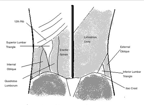 [PDF] Inferior lumbar triangle hernia as a rarely reported cause of low ...