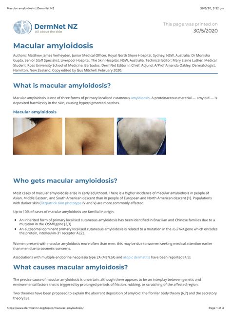 (PDF) Macular amyloidosis