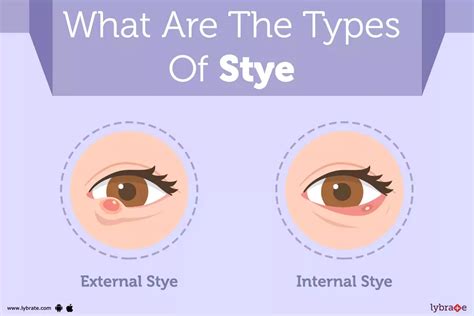 Stye: Causes, Symptoms, Treatment And Cost