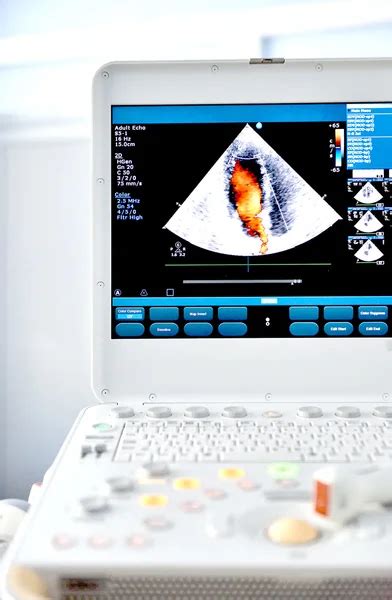 Ultrasound machine Stock Photo by ©Faustasyan 73768027