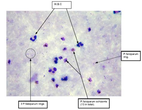 Malaria thick blood film - Celly.AI