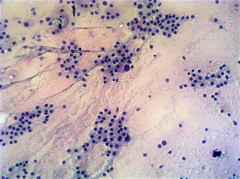 Course: differential diagnostics of follicular lesions