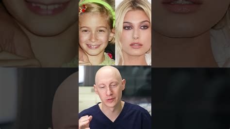 Hailey Bieber had a Nose Job? Plastic Surgeon Reacts - Клиника лазерной эстетики "Перлина".