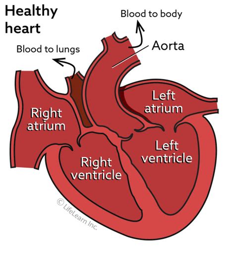 Congestive Heart Failure in Dogs | VCA Animal Hospital