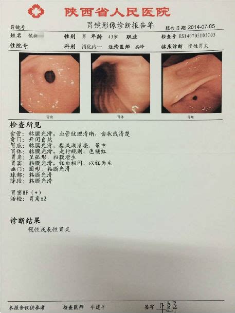 膏方治疗萎缩性胃炎患者的胃镜、病理前后对照（图片） - 微医（挂号网）