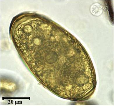 Paragonimus Westermani Egg Morphology