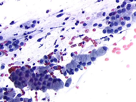 Histopathologie et cytopathologie du col utérin - atlas numérique ...