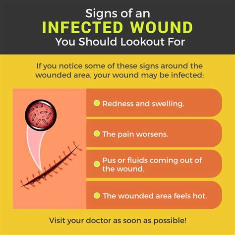 Signs of an Infected Wound You Should Lookout For #Signs #Infection ...