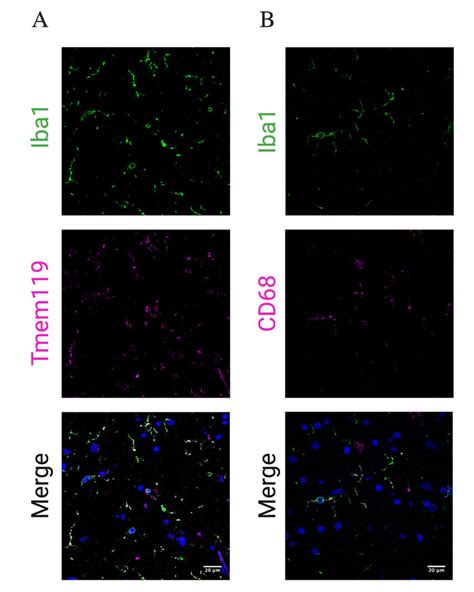 Figure S1. Validation of microglial markers in human post-mortem... | Download Scientific Diagram