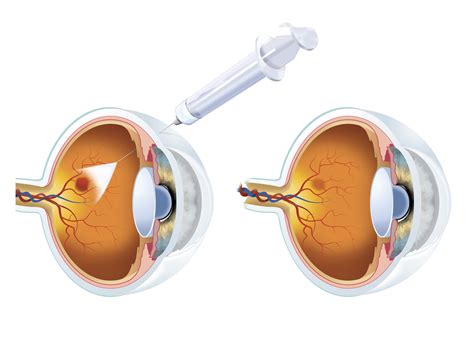 Ophthalmological Society of Jamaica