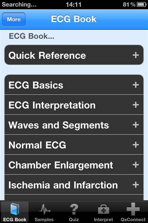 The best ECG apps for the iPhone