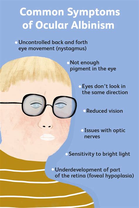 What Is Ocular Albinism?