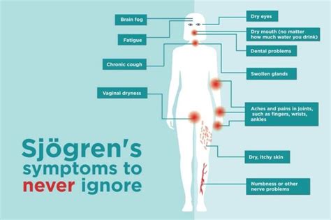 Sjögren’s Syndrome Symptoms You Might Be Ignoring | Sjogrens syndrome, Skin symptoms, Autoimmune ...