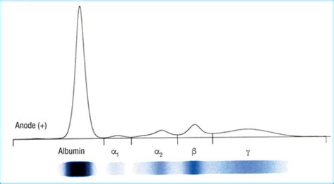 Electrophoresis Graph