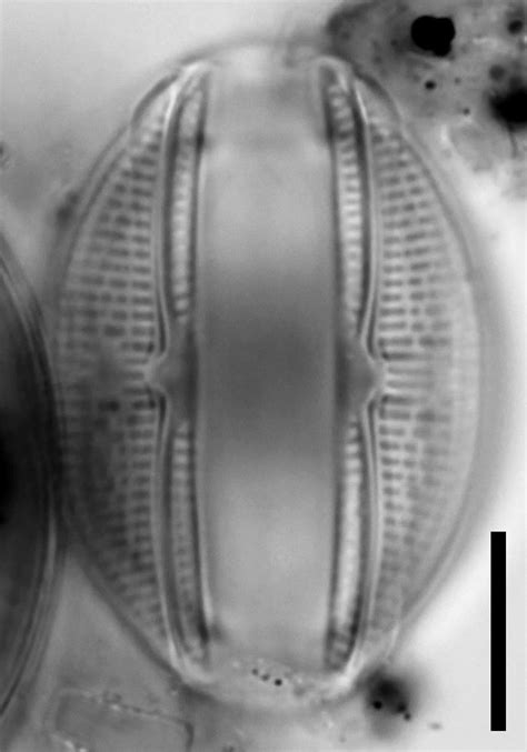 Algae World: images of meiosis in the diatom Amphora