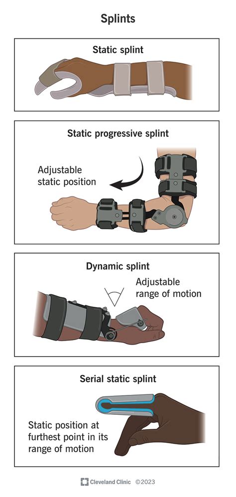 Splinting Orthosis PDF Thumb Anatomical Terms Of Motion, 50% OFF