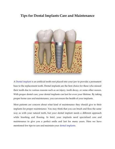 Tips for Dental Implants Care and Maintenance