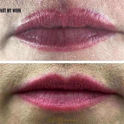 How to Safely Remove a Lip Tattoo: Expert Advice for a Successful Removal