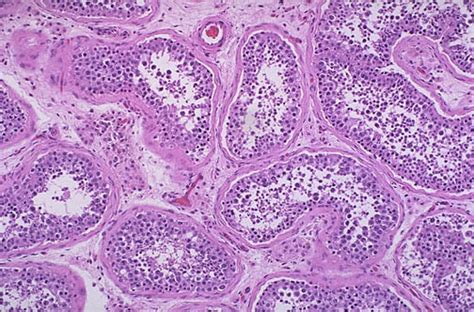 Seminiferous Tubules Histology