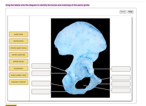 SOLVED: Drag the labels onto the diagram to identify the bones and markings of the pelvic girdle ...